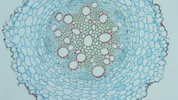 Cross section of sunflower root showing triarch vascular pattern.