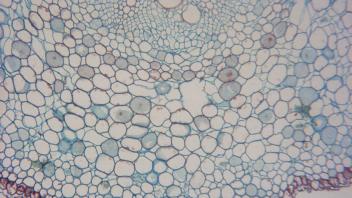 Enlarged section showing vascular cylinder and cortex in root.