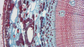 Tangential section showing resin ducts and ray cells in pine.