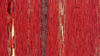 Tangential section highlighting elongated tracheids in oak.