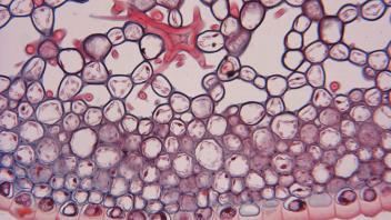 Detail of star-shaped sclereid cells in Trochodendron tissue.